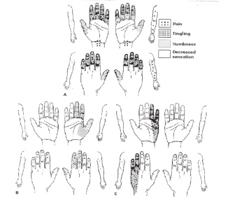 Diagram of various hands, showing areas of pain.